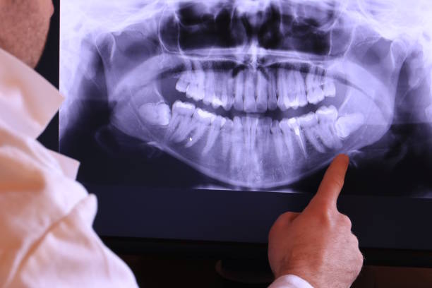 Best After-Hours Emergency Dentist in Mart, TX
